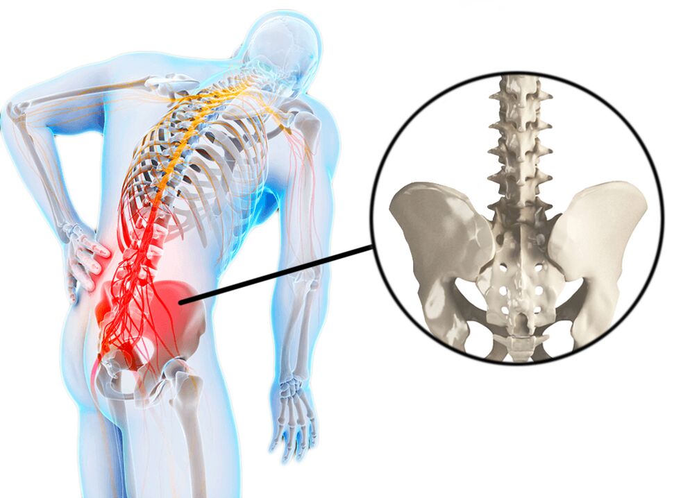 Pathologies of the spine are a common cause of pain in the lumbar region