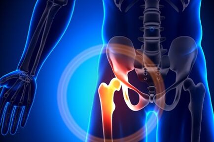 Hip pain