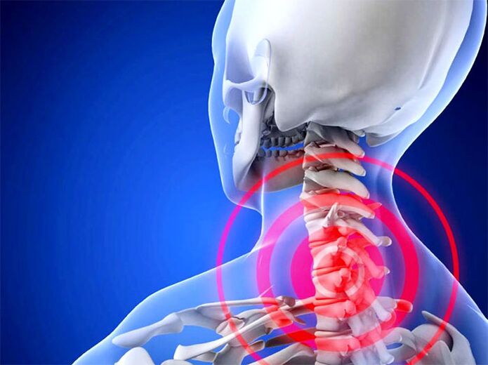 Cervical